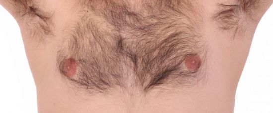 Chlupatí muži. Co už je příliš?