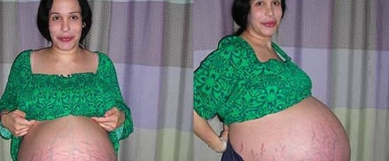 Ohromné břicho s osmerčaty před porodem