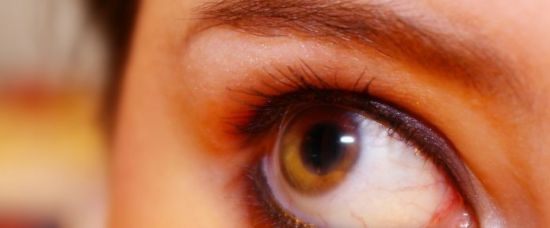 Omylem si zalepila oko lepidlem