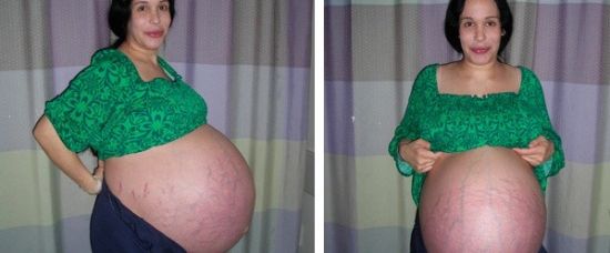 Měla už šest dětí a porodila osmerčata Měla už šest dětí a porodila osmerčata