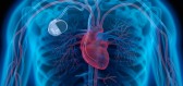 Kardiostimulátor neznamená nutně snížení kvality života