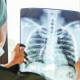 TuberkuIóza stále představuje celosvětové riziko