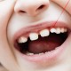 Mléčné zuby vašich dětí nevyhazujte. V budoucnu jim mohou zachránit život!
