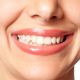 Jak šetrně bělit citlivé zuby?
