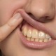 Žluté zuby ubírají na kráse a snižují sebevědomí