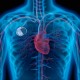 Kardiostimulátor neznamená nutně snížení kvality života